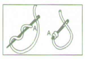 FrenchKnot